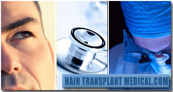 Hair Transplant Medical